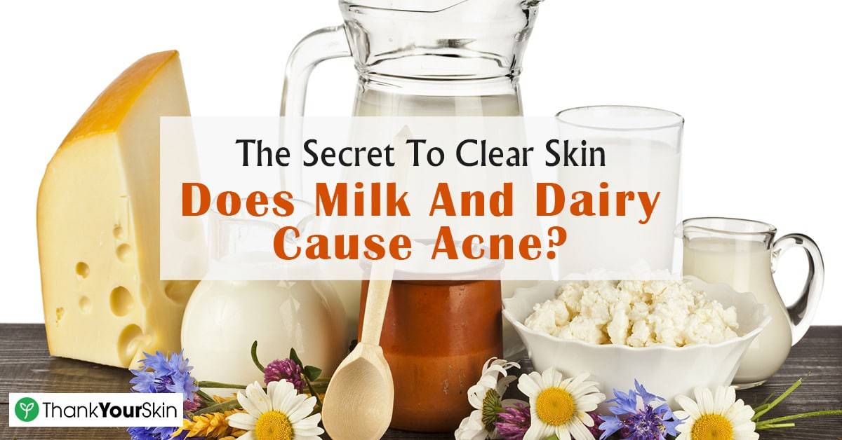 Dairy Elimination Diet Acne sagethepiratebay
