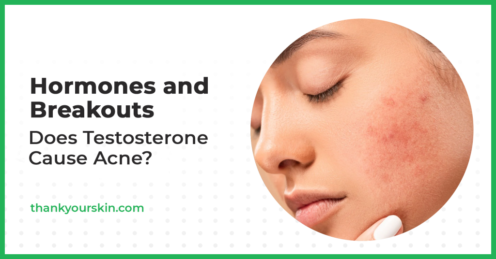 Does Testosterone Cause Acne? (Blame Your Hormones!)