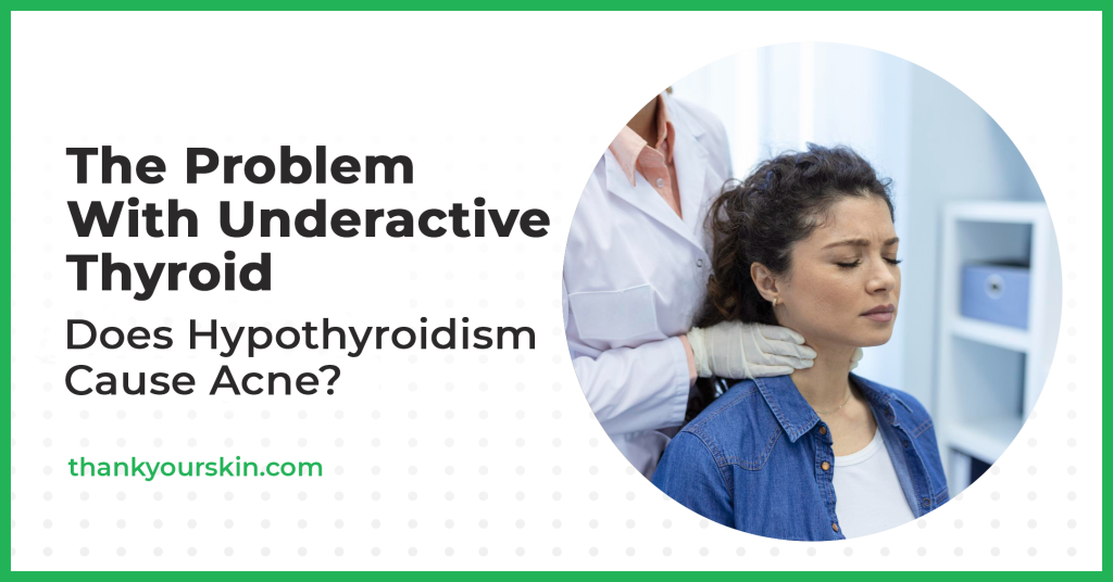 Does Hypothyroidism Cause Acne