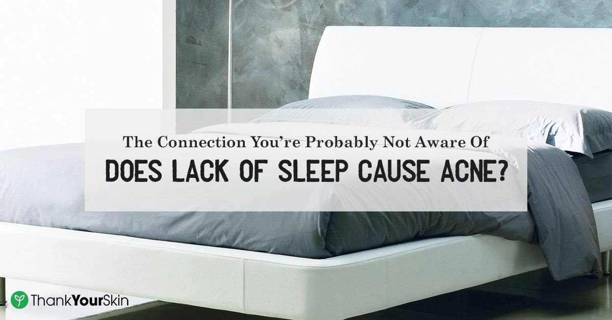 The Hidden Cause Of Your Acne Does Lack of Sleep Cause Acne?
