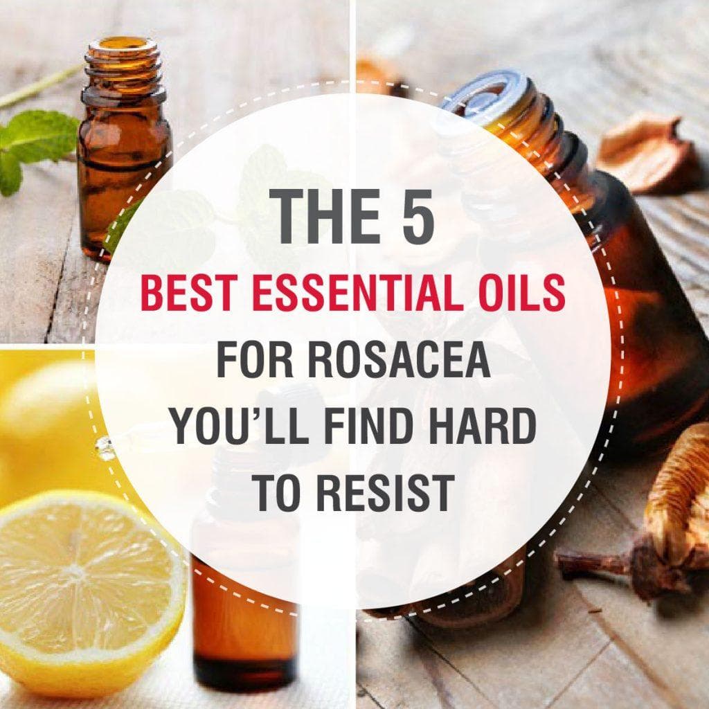 Best Essential Oils for Rosacea April 2021 Reviews and Top Picks