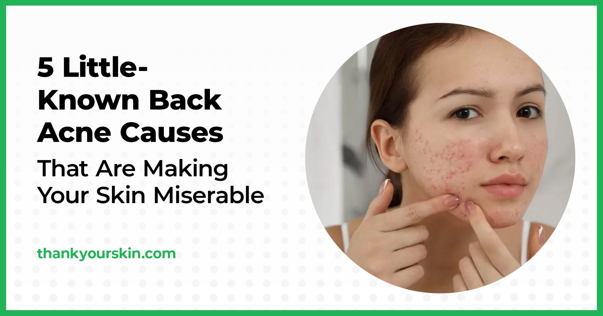 5 LittleKnown Back Acne Causes That Are Making Your Skin Miserable