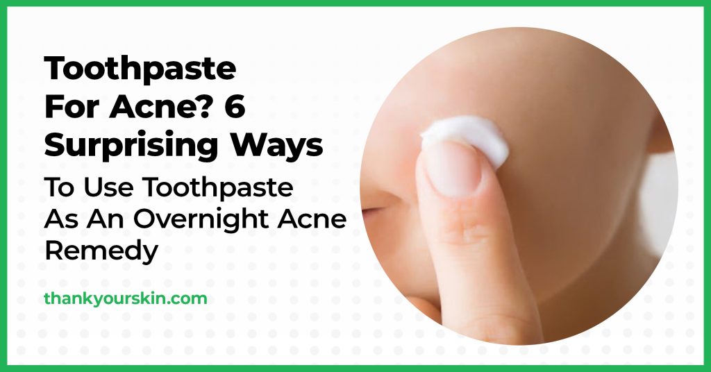 Toothpaste For Acne? 6 Surprising Ways To Use Toothpaste As An