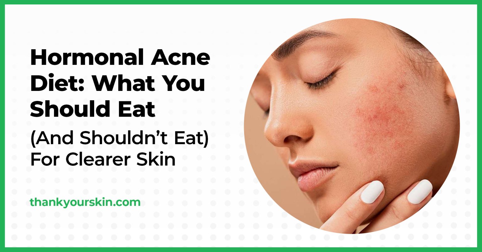 Hormonal Acne Diet What You Should Eat (And Shouldn't Eat) For Clearer Skin