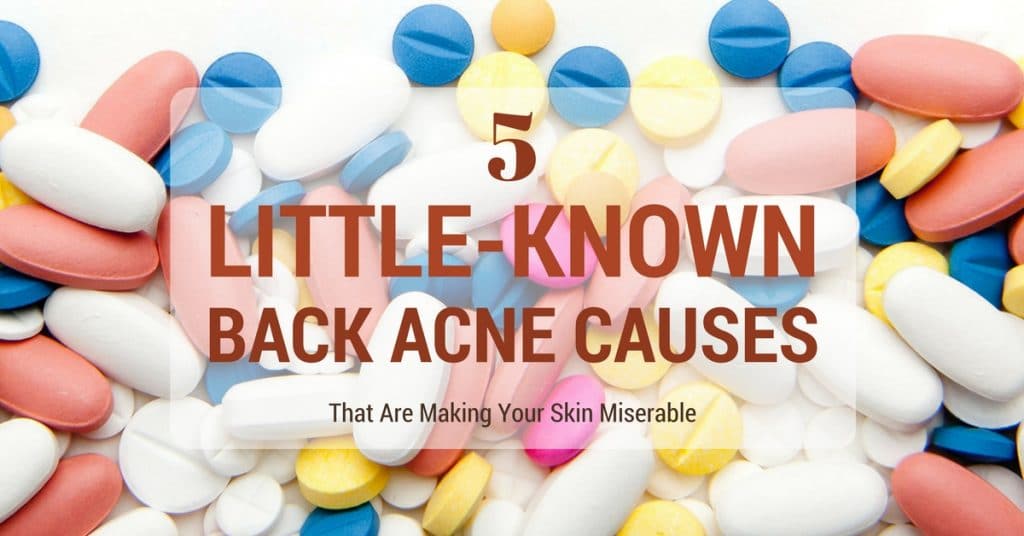 5 LittleKnown Back Acne Causes That Are Making Your Skin Miserable