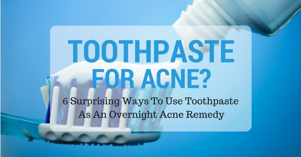 Toothpaste For Acne? 6 Surprising Ways To Use Toothpaste As An