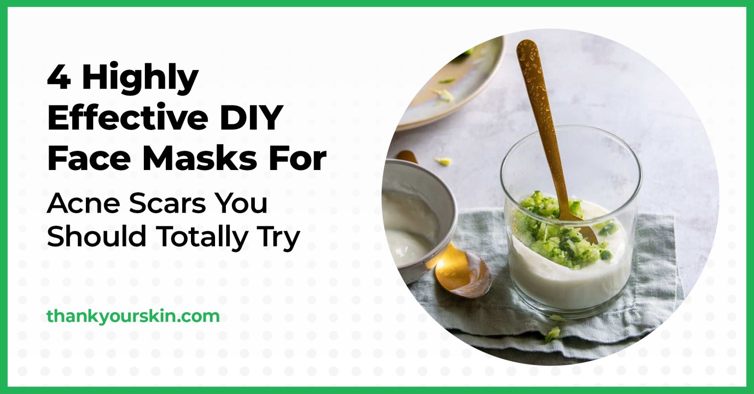 4 Highly Effective DIY Face Masks For Acne Scars You Should Totally Try