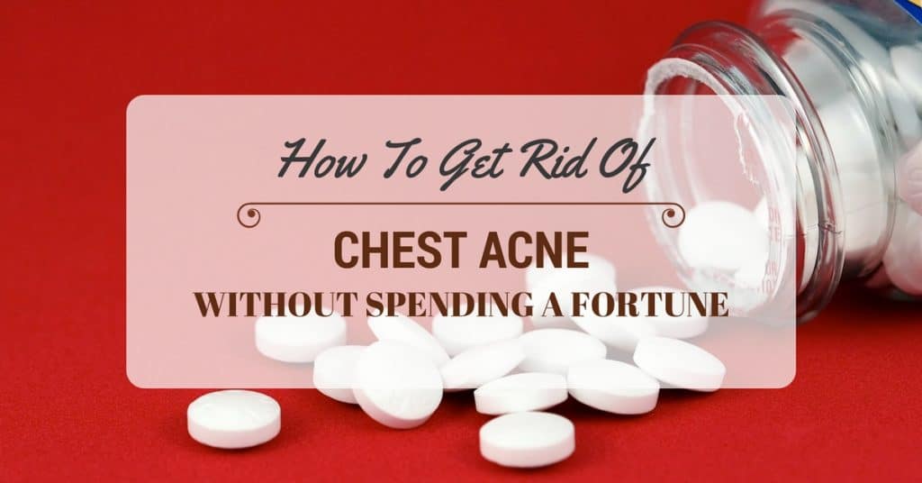 How to Get Rid of Chest Acne Without Spending a Fortune
