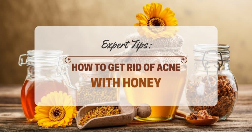 Expert Tips How To Get Rid of Acne With Honey
