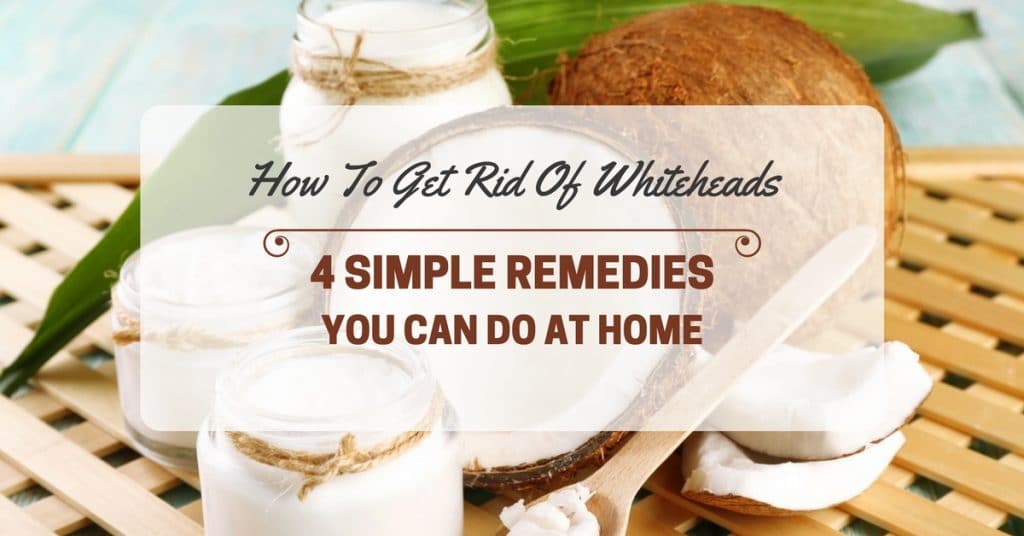 How to Get Rid of Whiteheads 4 Simple Remedies You Can Do At Home