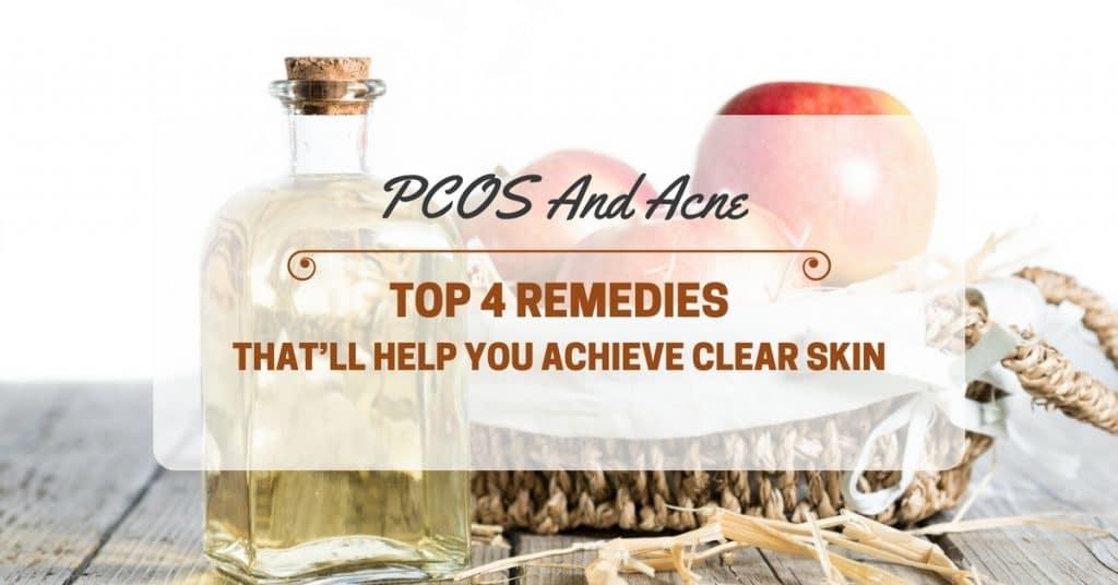 PCOS And Acne Top 4 Remedies That’ll Help You Achieve Clear Skin